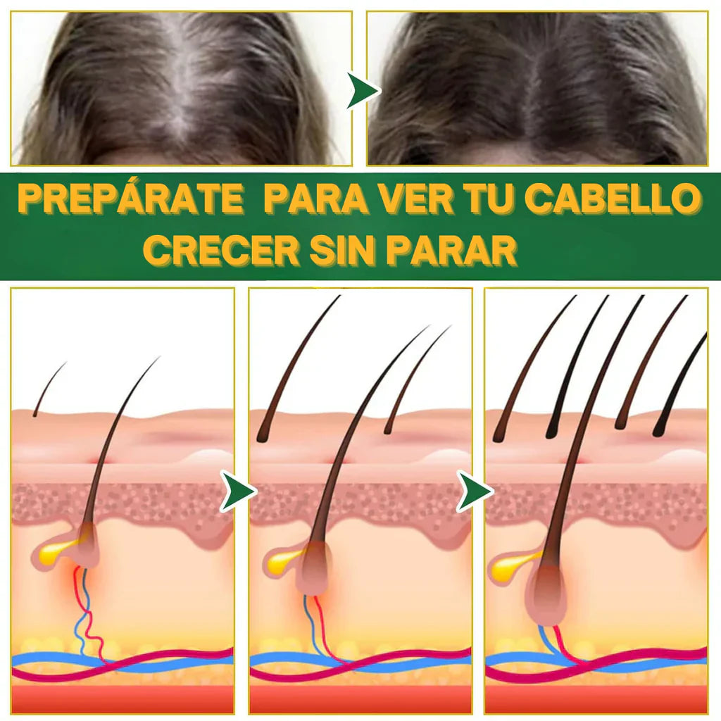 CONTROL DE CAIDA Y CRECIMIENTO DE CABELLO OUHOE