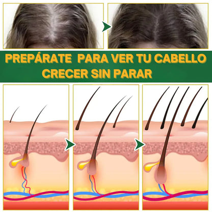 CONTROL DE CAIDA Y CRECIMIENTO DE CABELLO OUHOE